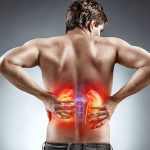 Back Pain