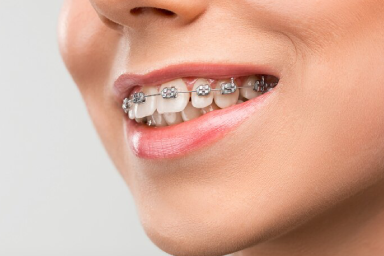 PR Dental is the best dental clinic in Trivandrum providing root canal treatment, braces, implants, and cosmetic dentistry with modern technology and expert doctors.