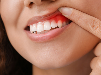 Advanced dental services at PR Dental Clinic in Trivandrum featuring modern equipment and expert dental care