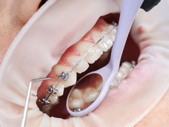 “Modern treatment room at PR Dental Clinic in Trivandrum featuring advanced dental equipment and comfortable patient care facilities.”