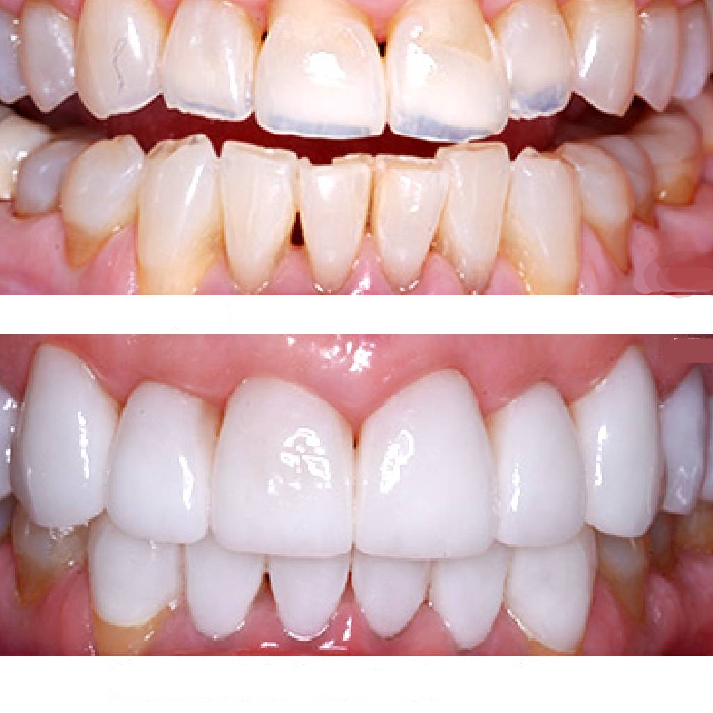 Best root canal treatment at PR Dental Clinic in Trivandrum by experienced dental specialists.